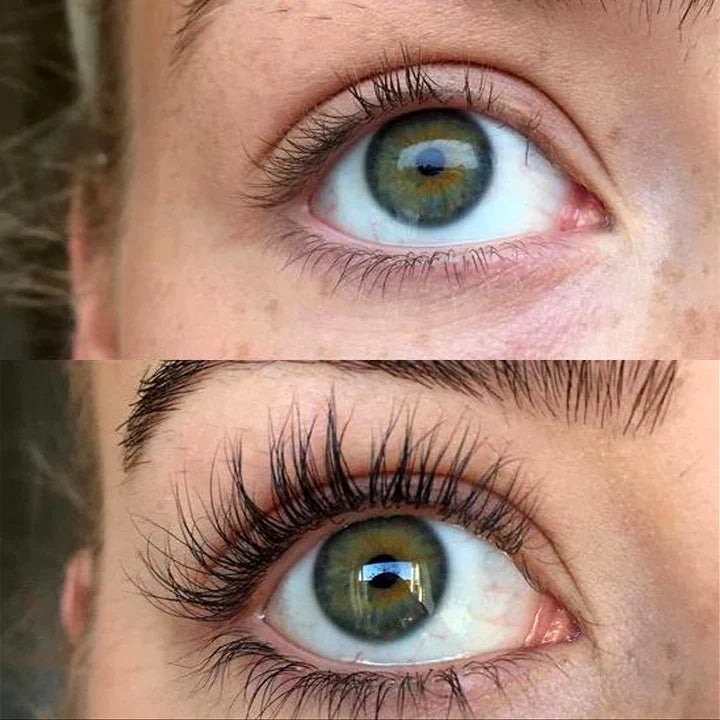 QUALASH Advanced Eyelash Serum으로 속눈썹 길이와 볼륨이 눈에 띄게 향상된 전후 사진