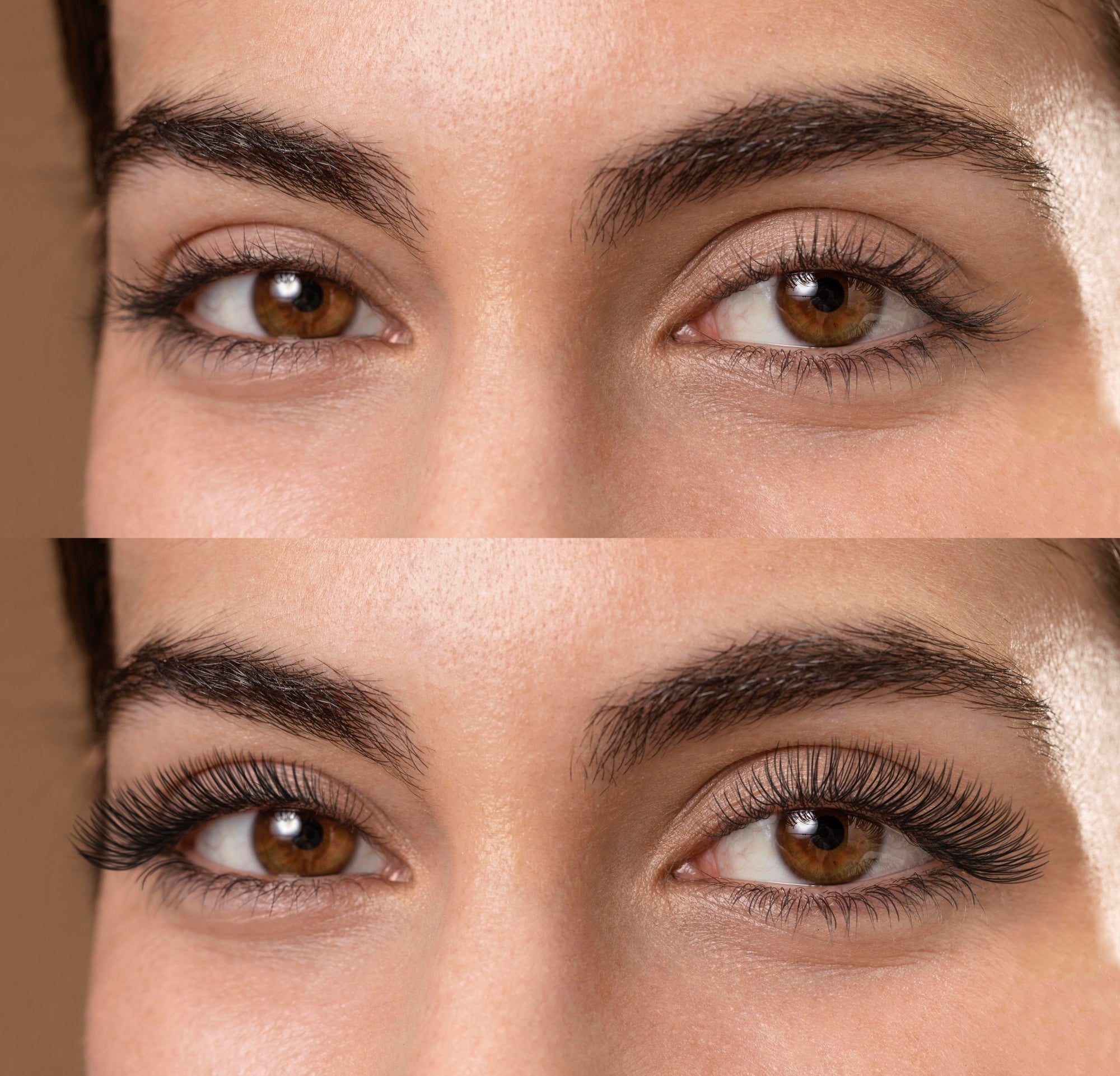 Thyroid and Eyelash/Eyebrow Loss – What You Need to Know